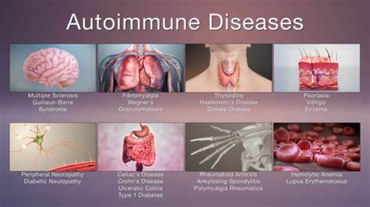 Are allergies and autoimmune diseases related