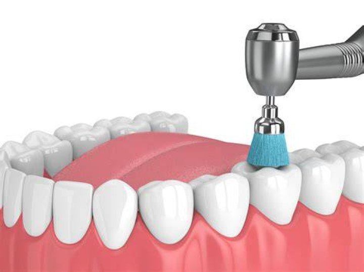 Are dental assistants allowed to polish teeth