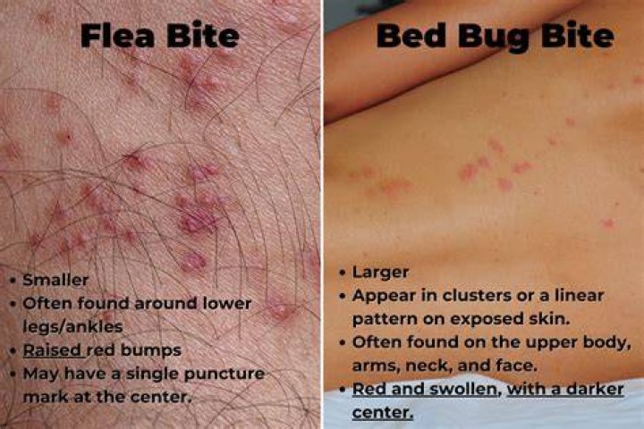 Are there any side effects from bed bug bites