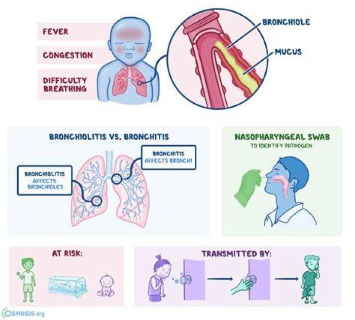 Can bronchiolitis cause permanent lung damage