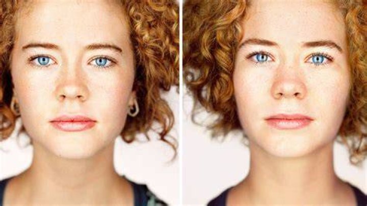 Can twins be identical if they look different