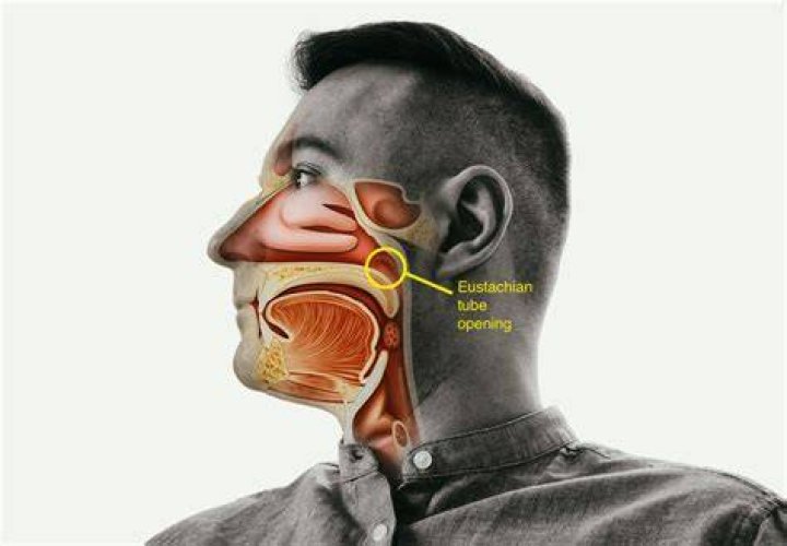 Does a blocked Eustachian tube cause tinnitus