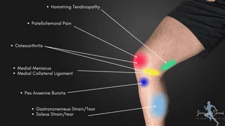 How do I stop my knee and thighs from hurting