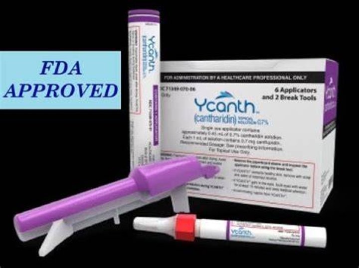 How long does it take for cantharidin to work