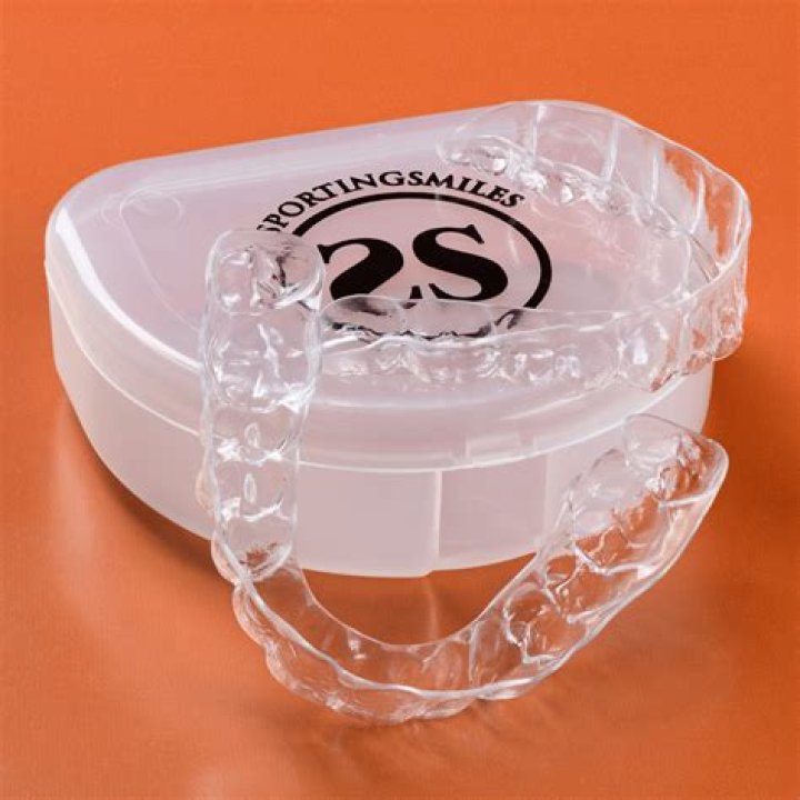 How much is retainer for teeth in Philippines