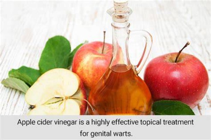 Is apple cider vinegar safe for genital warts