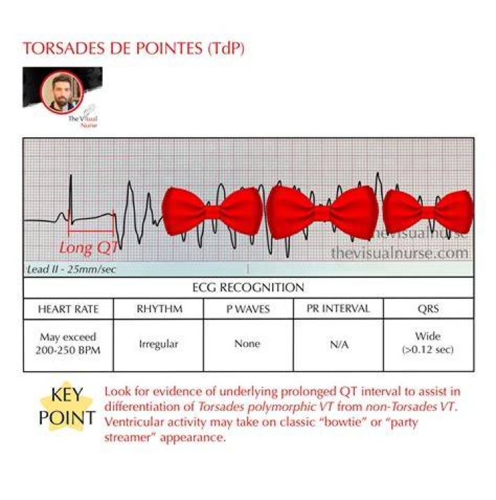 What does torsades de pointes mean in English