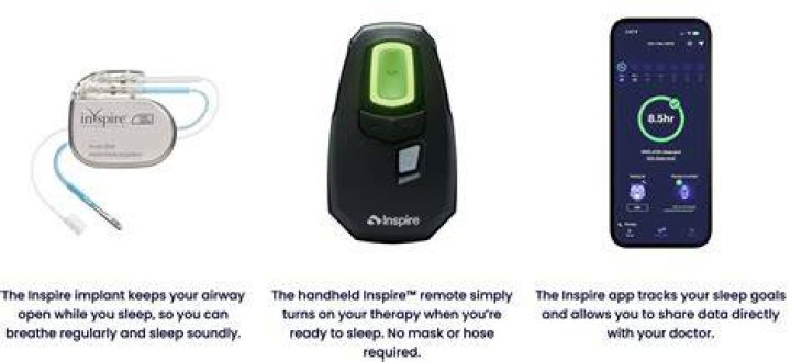 What is the latest technology for sleep apnea