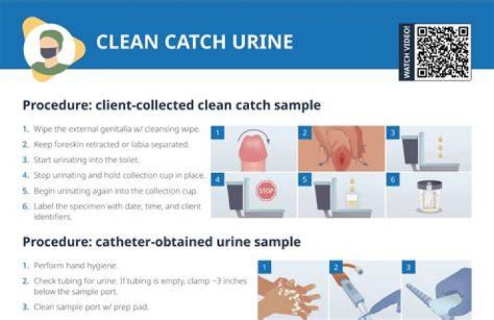 Why do you have to wipe before a urine sample